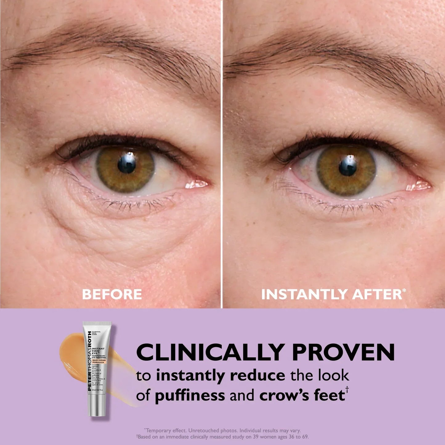 Instant Eye Tightener