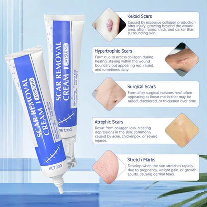 Professional Scar Removal Cream