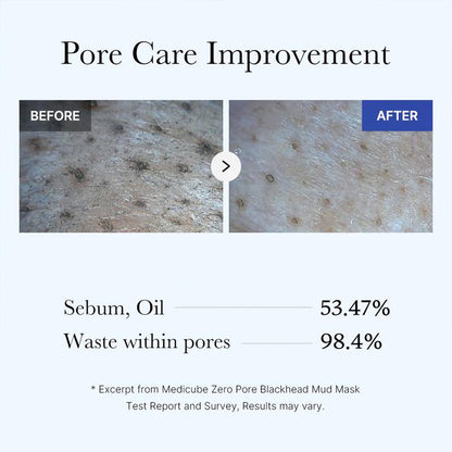 ClearPore™ Deep-Cleanse Mud Mask