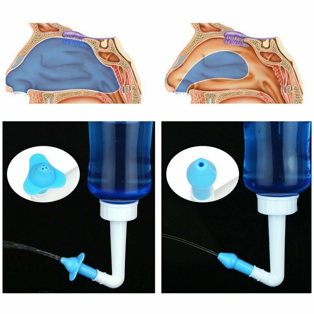 Nasal Rinse Bottle Kit for Sinus & Allergy Relief